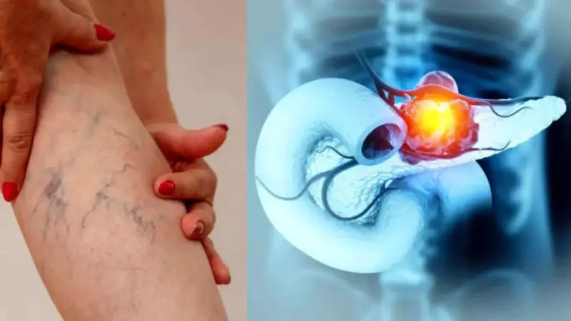 మీ కాళ్లలో ఈ మార్పులు కనిపిస్తున్నాయా? అయితే జాగ్రత్త, అవి క్యాన్సర్ సంకేతాలే!