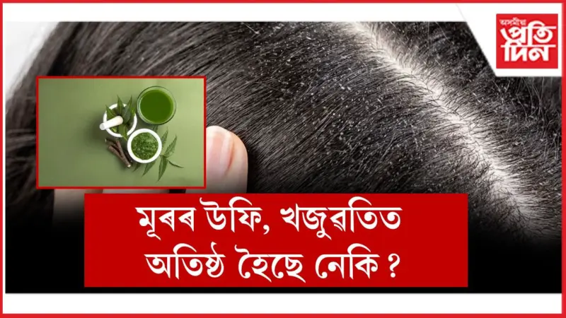 দামী-দামী ছেম্পুৰ সলনি ব্যৱহাৰ কৰক এই ৫ ঘৰুৱা উপায়