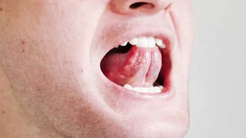 Touching the Roof of Your Mouth with Your Tongue: Incredible Benefits You'll See in Just 1 Minute