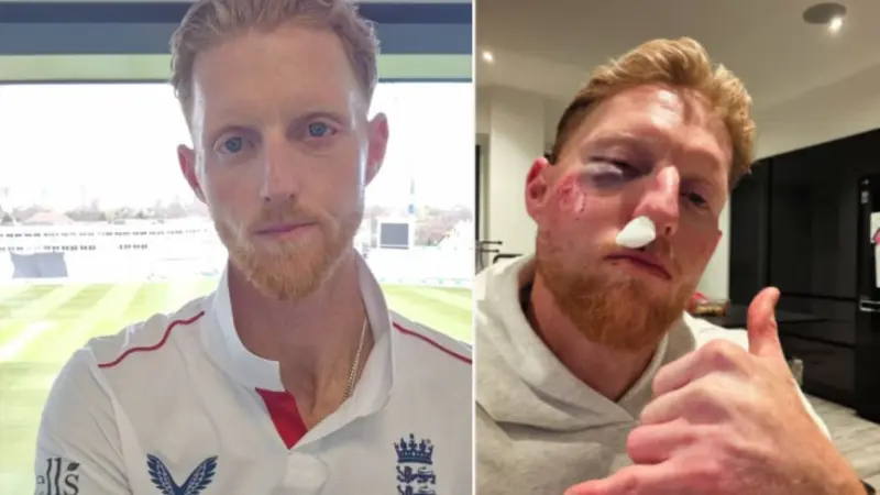 Post-Surgery Transformation Leaves Fans Stunned: Ben Stokes Goes Viral for Dramatic New Look