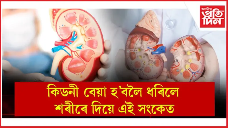Kidney Health: অৱহেলা নকৰিব, লক্ষণ চিনি লৈ সাৱধান হওঁক