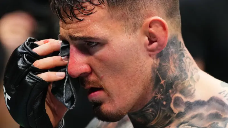 Eye Poke to Tom Aspinall at UFC 321 Led to Blurry Outcome, Reveals Father
