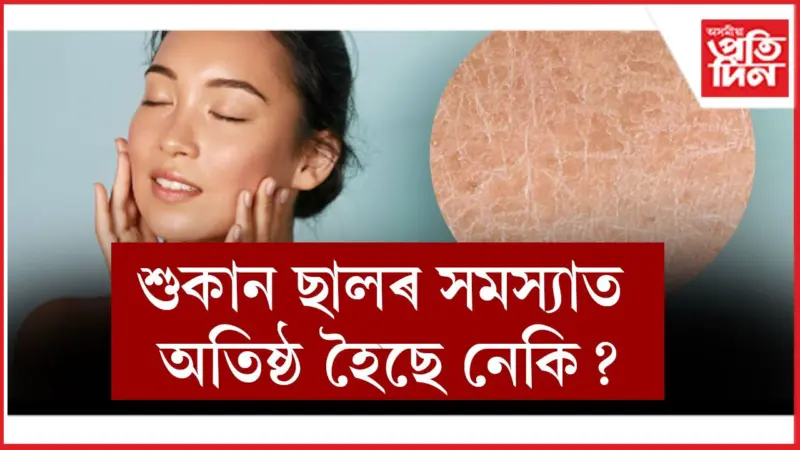 Skincare: এই খাদ্য খালে শীতকালতো জিলিকি থাকিব আপোনাৰ ছাল