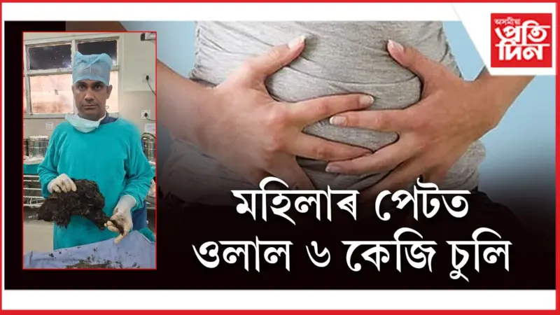 সাৱধান হওঁক, অন্যথা আপুনিও ভুগিব এই ৰোগত