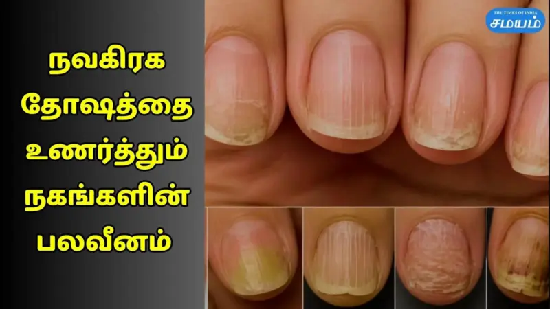 நகங்களின் நிறம், அமைப்பு உணர்த்தும் நவகிரக தோஷம் - எளிய பரிகாரம்