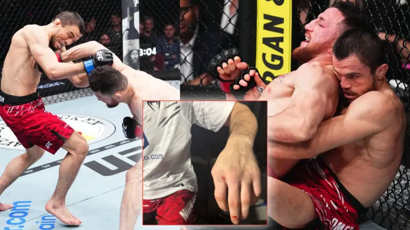 Umar Nurmagomedov injury:  Fans call out Team Khabib for 'excuses' after Merab Dvalishvili domination at UFC 311