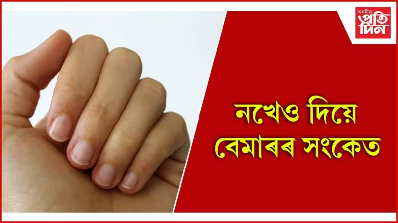 নখৰ ৰং চায়েই গম পাওঁক স্বাস্থ্যৰ স্থিতি