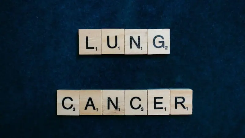 Small Cell Lung Cancer: New hope for lung cancer patients, an AI tool will predict the effect of treatment in advance