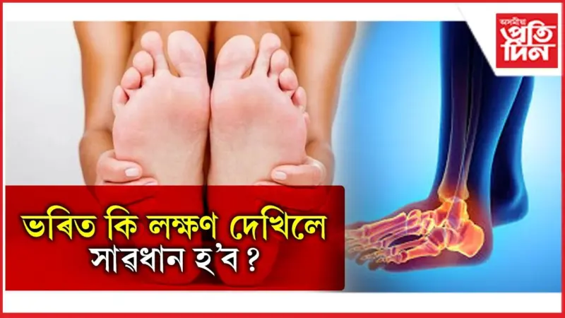 ভৰিৰ সঠিক যত্ন নল'লে নীৰৱে বৃদ্ধি পায় ভয়াৱহ ৰোগ