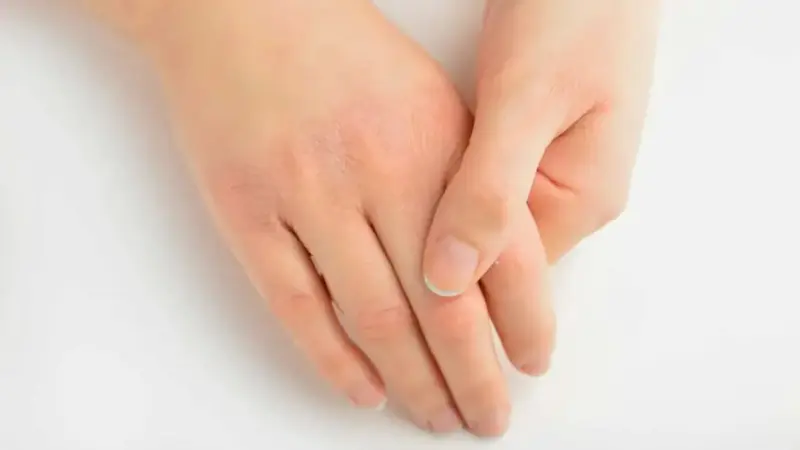 इस विटामिन की कमी से फटने लगती है स्किन, इस तरह करें पूर्ति: Vitamin Deficiency Causes Skin Problems