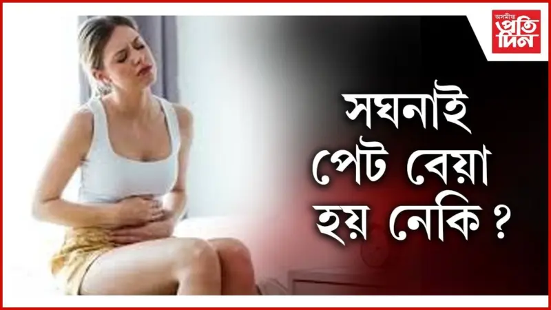 ফাৰ্মাচীলৈ যাব নালাগে, ঘৰতে আছে পেটৰ অসুখৰ ঔষধ