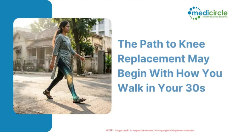 The Path to Knee Replacement May Begin With How You Walk in Your 30s