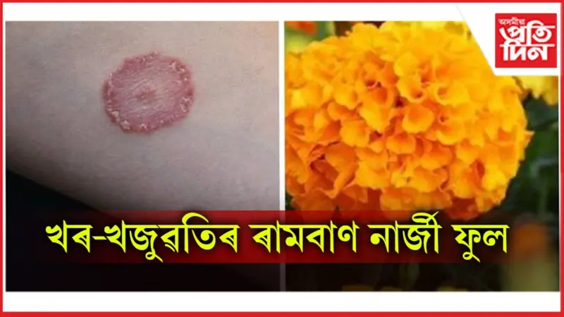 নাৰ্জী ফুলৰ ঔষধি গুণৰ বিষয়ে জানেনে ?