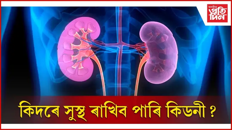 এইসকলৰ যিকোনো সময়তে হ'ব পাৰে কিডনীৰ ৰোগ