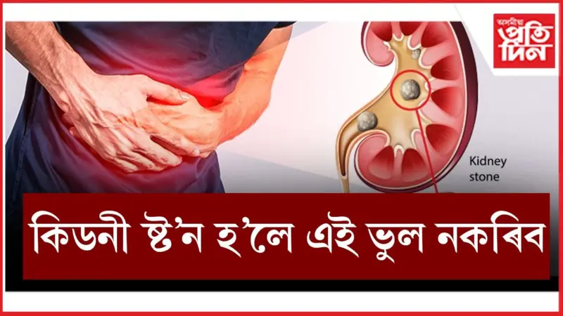 ঘৰতে কৰিব পাৰি 'কিডনী ষ্ট'ন'ৰ চিকিৎসা