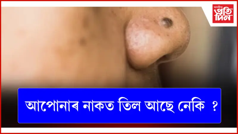 তিলটোয়েই দিয়ে ব্যক্তিৰ স্বভাৱ-ভাগ্যৰ খবৰ
