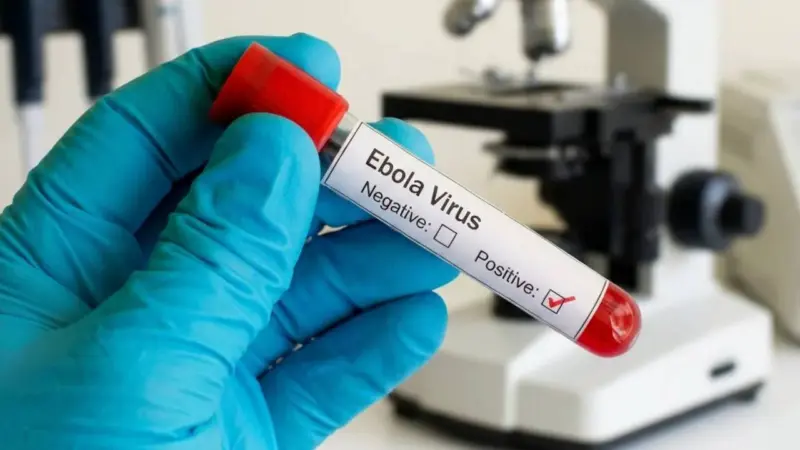 Ebola Virus: ইবোলার আঁচ ভারতেও! বিমানবন্দরে জারি সতর্কতা!