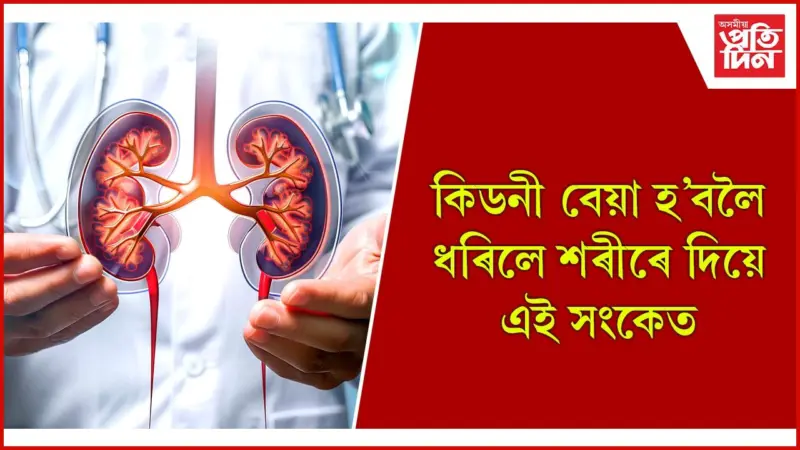 Kidney Health: অৱহেলা নকৰিব, লক্ষণ চিনি লৈ সাৱধান হওঁক