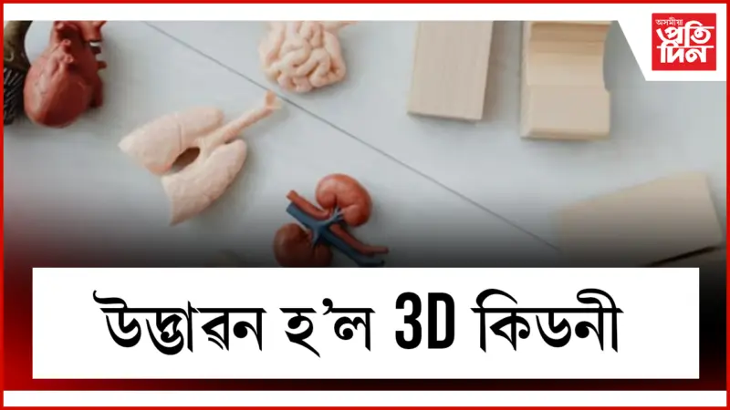 ৰোগীক ৩৪ সপ্তাহ অধিক জীয়াই ৰাখিব এই কৃত্ৰিম কিডনীয়ে