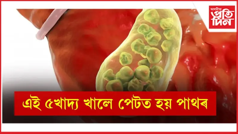 কি খাদ্যই শৰীৰত বিহৰ কাম কৰে চিনি থওঁক