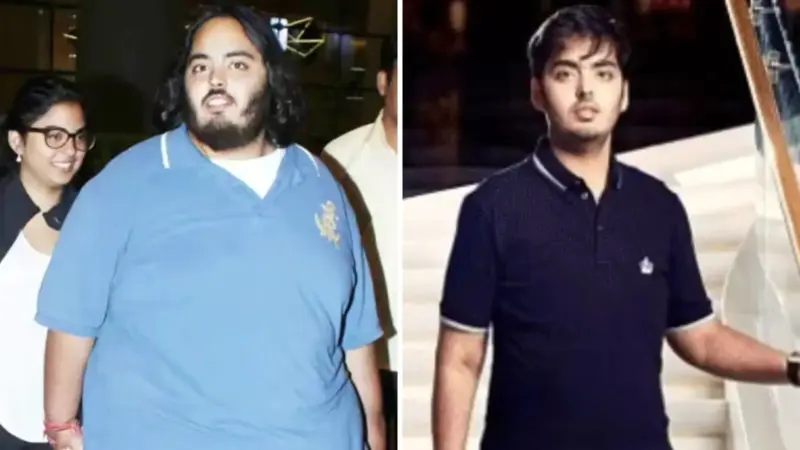 The Truth About Anant Ambani's Health: His Unseen Struggles And Transformation