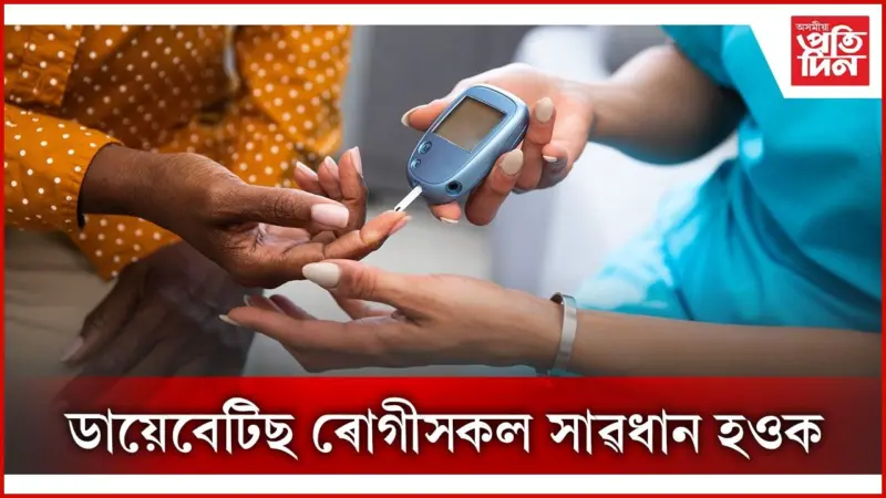 গৰমত এইসমূহ খাদ্য ভুলতো নাখাব