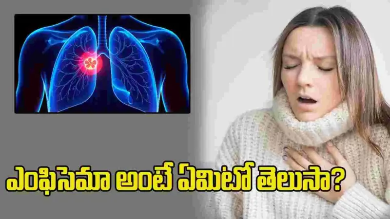 శ్వాస తీసుకోవడంలో ఇబ్బందా? ఎంఫిసెమా వ్యాధి గురించి తెలుసుకోండి