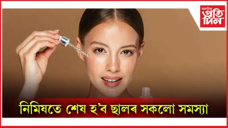 ক্ৰীম নহয়, ছালত ব্যৱহাৰ কৰক গ্লিচাৰিণ