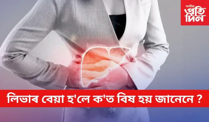 এইসমূহ লিভাৰ দুৰ্বল হোৱাৰ লক্ষণ, উপেক্ষা নকৰিব