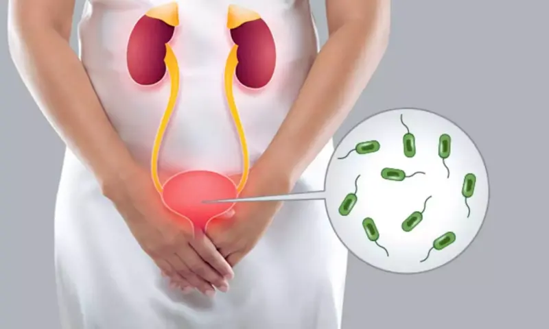 Health Tips: సమ్మర్లో యూరిన్ ఇన్ఫెక్షన్లు రాకుండా ఉండాలంటే..