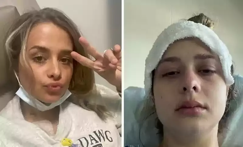 महिला को सालों से आती थी डकारें डॉक्टर के पास गई तो उसके भी पैरों तले खिसक गई जमीन