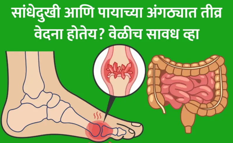 High Uric Acid Symptoms: युरिक अॅसिड वाढलंय? युरिक अॅसिड म्हणजे काय? जाणून घ्या लक्षणं आणि 5 रामबाण उपाय