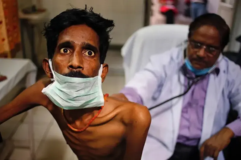 World TB Day 2026: Date, theme, history and India's fight to end disease