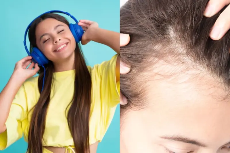 Hairfall: Can Your Headphone Use Make You Bald? Top Nutritionist Weighs In