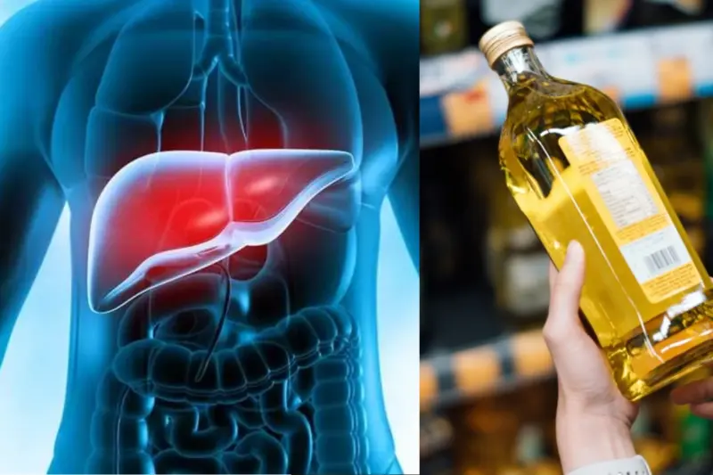 Liver Damage: Why Industrial Seed Oils Beat Sugar As Top Enemy? Top Health Expert Reveals Hidden Truth