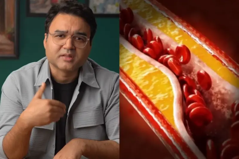 Heart Artery Plaque Reversal: Not Cholesterol Alone - These Are The Silent Trio Behind Most Heart Attacks, Check Video
