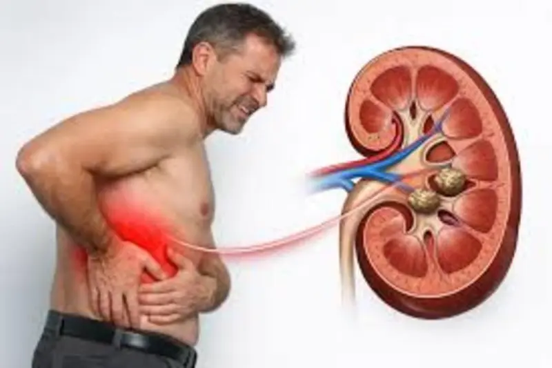 Kidney Stone को बिना दवा के निकाल देता है ये छोटा सा पत्ता, पथरी के दर्द से जूझ रहे लोग जरुर करें ट्राई