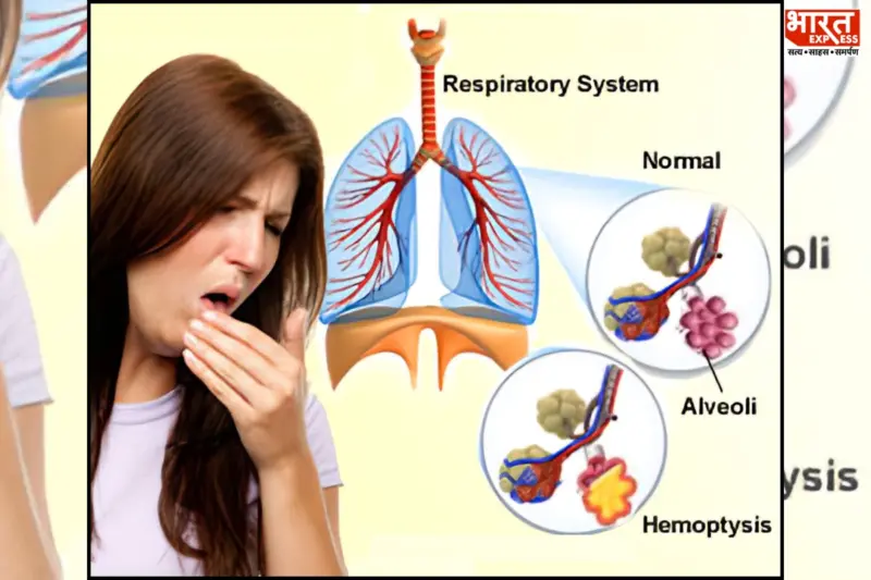 Coughing Up Blood? Here's When It Could Signal A Serious Health Risk