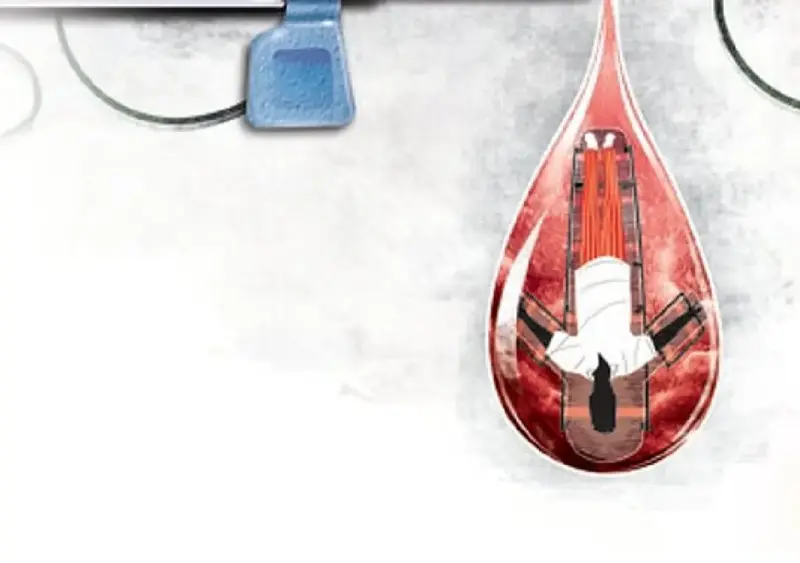 Bengaluru doctor booked after woman dies post tubectomy