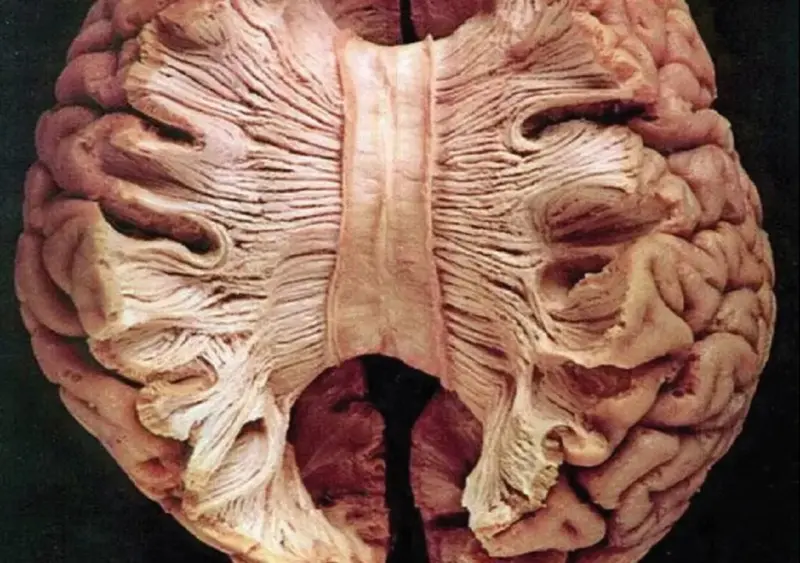 Dr N Someshwara Column: ಆಲ್ಬರ್ಟ್ ಐನ್ಸ್ಟೀನ್ʼರ ಮಿದುಳನ್ನು ಕತ್ತರಿಸಿದಾಗ...
