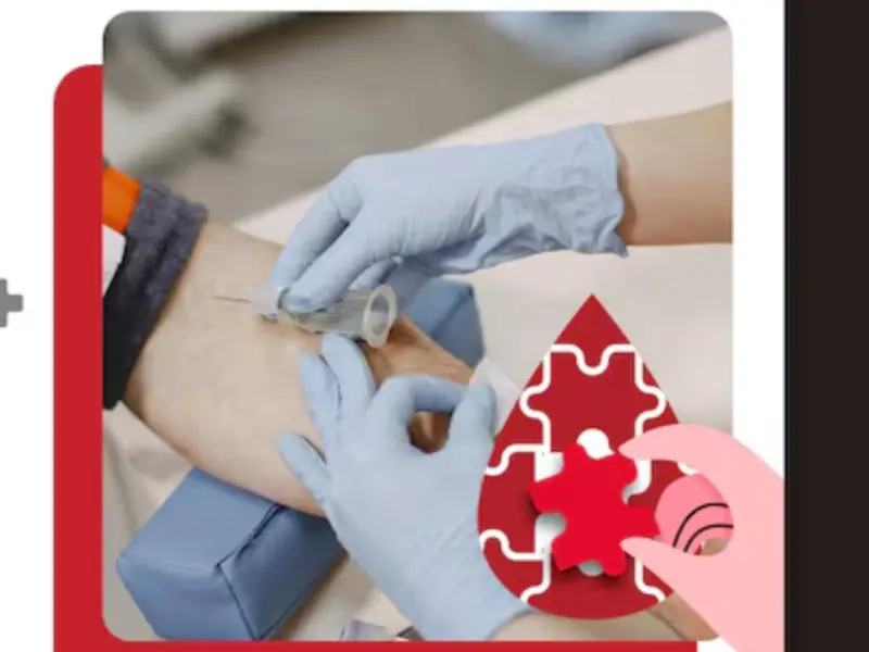 Why Thousands Of Hemophilia Cases Are Missed Until Severe Bleeding Occurs, Doctors Share Insights