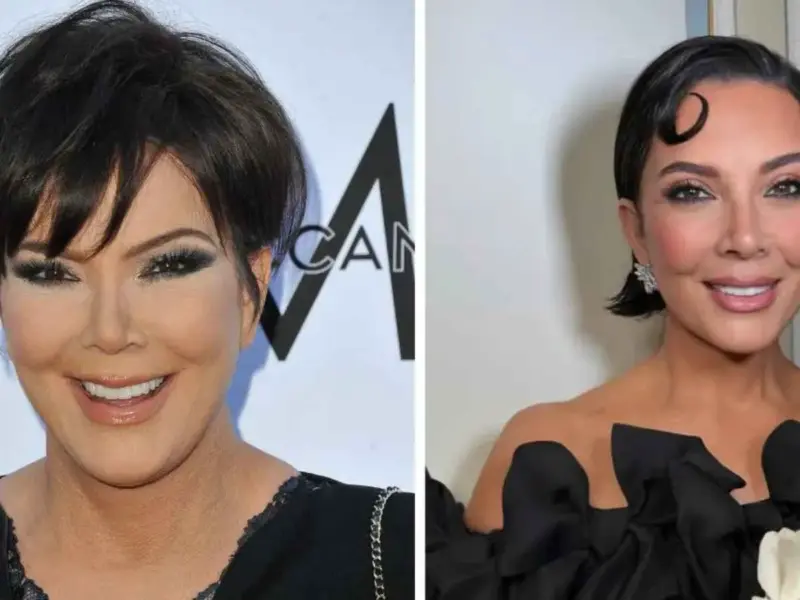 From Botox to Facelifts: Kris Jenner's Complete Plastic Surgery Breakdown