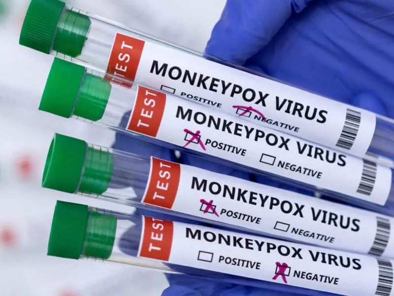 First 'Suspected' Monkeypox Case In India