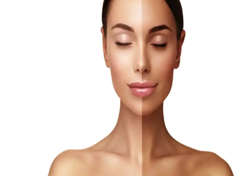 Effective Home Remedies for Sun Tan Removal