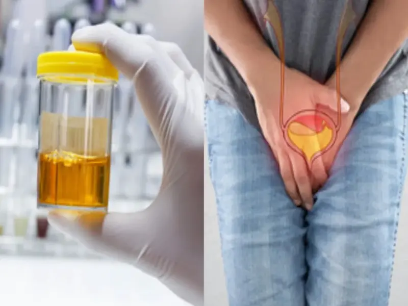 Urine Color- आपके पेशाब का रंग बताता हैं आपकी सेहत कैसी हैं, आइए जानें पूरी डिटेल्स