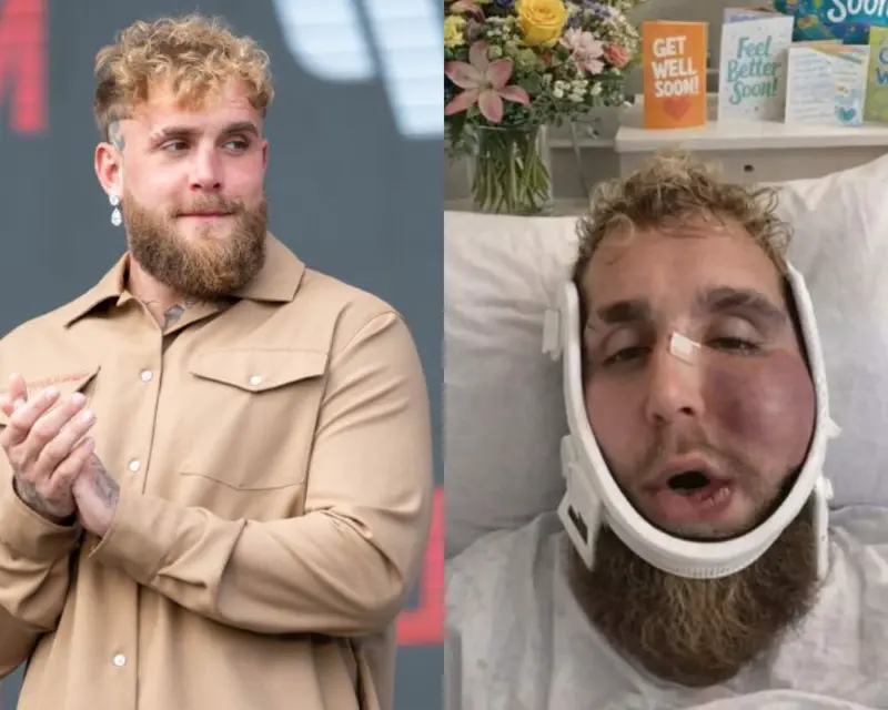 FACT Check: Did Jake Paul Say His Boxing Career Is Over After Brutal Jaw Fracture Against Anthony Joshua? Details Inside