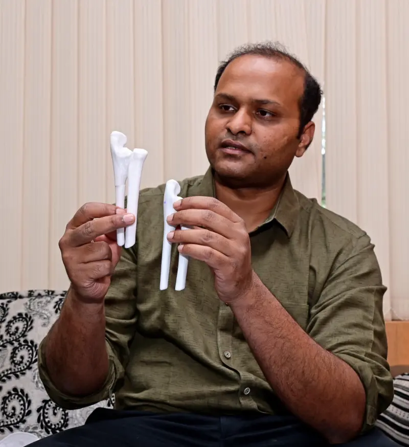 ಸಂಜಯ ಗಾಂಧಿ ಆಸ್ಪತ್ರೆ: ಮೂಳೆ ಮುರಿತಕ್ಕೆ '3ಡಿ ಮುದ್ರಣ' ಶಸ್ತ್ರಚಿಕಿತ್ಸೆ ಆರಂಭ