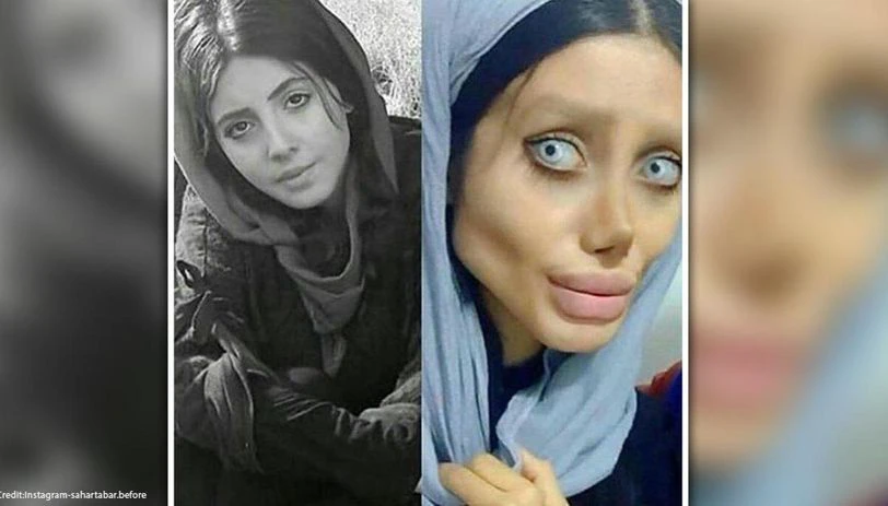 Instagram Star Who Underwent Surgeries To Look Like Angelina Jolie Contracts COVID-19