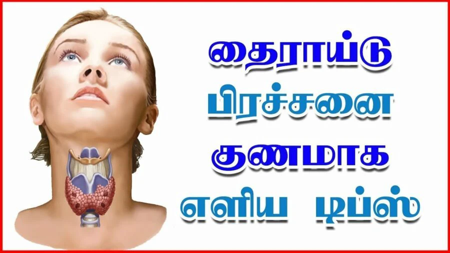  தைராய்டு குணமாக வீட்டு வைத்தியம்:- 22a000b1fe268d4f518a9749283e8737c4c4e8a5fce5a62c8ce83ba4634ce09f