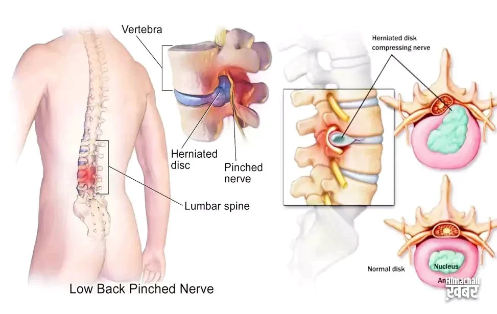 कीमतों ने तोड़ा रिकॉर्ड, फिर भी इस जादुई फल को खरीदने की मची होड़!